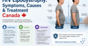HIV Lipodystrophy: Symptoms, Causes & Treatment Canada