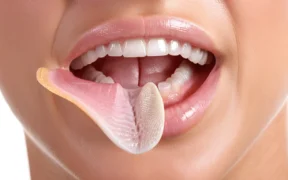 Burned Tongue Symptoms Treatment 038 When to See a Doctor - Canadian health information
