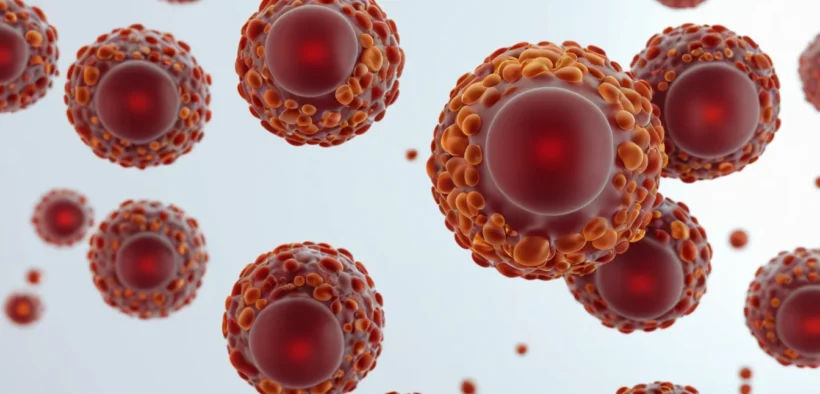 Hemolytic Anemia Symptoms Causes 038 Treatment - Canadian health information