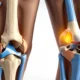 Leg Pain Causes Symptoms 038 When to Act - Canadian health information